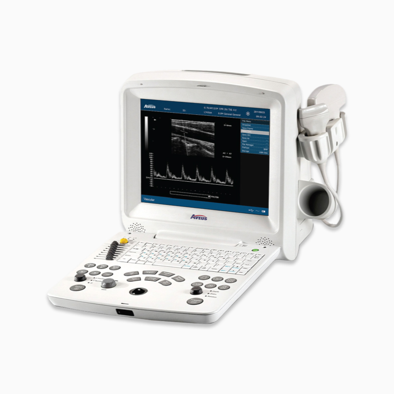 AV-60 Digital Ultrasonic Diagnostic Imaging System